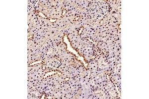 Immunohistochemistry (Paraffin-embedded Sections) (IHC (p)) image for anti-TBC1 (Tre-2/USP6, BUB2, Cdc16) Domain Family, Member 1 (TBC1D1) antibody (ABIN7075843)