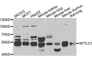 Western blot analysis of extracts of various cell lines, using SPTLC1 antibody (ABIN5974083) at 1/1000 dilution. (SPTLC1 抗体)