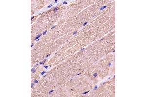 Antibody staining MYBPC3 in human skeletal muscle tissue sections by Immunohistochemistry (IHC-P - paraformaldehyde-fixed, paraffin-embedded sections). (MYBPC3 抗体  (N-Term))