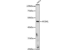 Western blot analysis of extracts of HeLa cells, using M1 antibody (ABIN6129914, ABIN6136958, ABIN6136959 and ABIN6218150) at 1:500 dilution. (AP2M1 抗体  (AA 134-433))