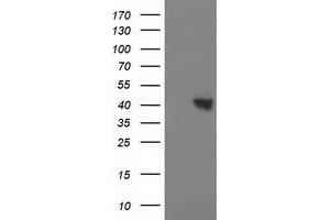 Western Blotting (WB) image for anti-Sulfotransferase Family, Cytosolic, 1C, Member 2 (SULT1C2) antibody (ABIN1501230) (SULT1C2 抗体)
