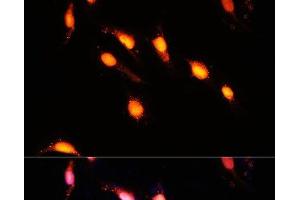 Immunofluorescence analysis of U-2 OS cells using GTF3C4 Polyclonal Antibody at dilution of 1:100 (40x lens). (GTF3C4 抗体)