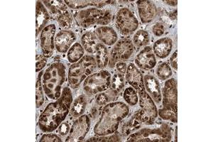 Immunohistochemical staining of human kidney with ZFAND2B polyclonal antibody  shows strong cytoplasmic and nuclear positivity in cells in tubules at 1:10-1:20 dilution. (ZFAND2B 抗体)