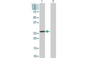 Western Blot analysis of HOXB1 expression in transfected 293T cell line by HOXB1 MaxPab polyclonal antibody. (HOXB1 抗体  (AA 1-235))