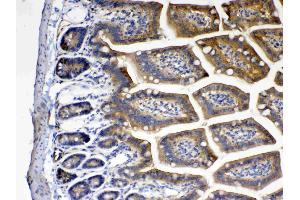 IHC analysis of CD151 using anti- CD151 antibody .
