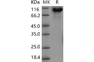 Western Blotting (WB) image for Transferrin (TF) (Active) protein (Fc Tag) (ABIN7320135) (Transferrin Protein (TF) (Fc Tag))