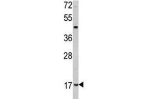 Western blot analysis of Leptin antibody MDA-MB231 lysate. (Leptin 抗体  (AA 134-166))