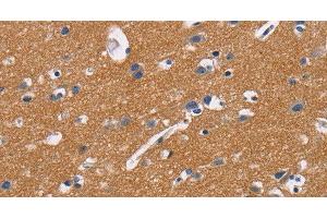 Immunohistochemistry of paraffin-embedded Human brain tissue using CD47 Polyclonal Antibody at dilution 1:50 (CD47 抗体)