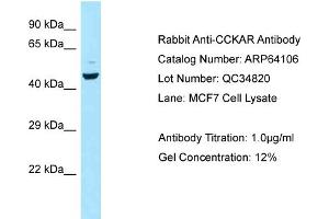 Western Blotting (WB) image for anti-Cholecystokinin A Receptor (CCKAR) (C-Term) antibody (ABIN2789733) (CCKAR 抗体  (C-Term))