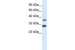 WB Suggested Anti-TAL1 Antibody Titration:  0. (TAL1 抗体  (Middle Region))