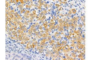 ABIN6261404 and ABIN6266530 at 1/100 staining Rat ovarian tissue by IHC-P. (Dysferlin 抗体  (C-Term))