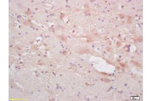 Formalin-fixed and paraffin embedded rat brain labeled with Rabbit Anti NF66/alpha Internexin Polyclonal Antibody, Unconjugated (ABIN739830) at 1:200 followed by conjugation to the secondary antibody and DAB staining (INA 抗体  (AA 251-350))