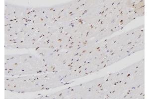 ABIN6274272 at 1/100 staining Mouse heart tissue by IHC-P. (FXR2 抗体  (C-Term))