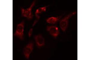 ABIN6274425 staining HepG2 cells by IF/ICC. (DCLK2 抗体  (N-Term))