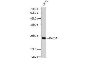 Western blot analysis of extracts of MCF7 cells, using RA antibody (ABIN3021646, ABIN3021647, ABIN3021648 and ABIN1513457) at 1:500 dilution. (RAB5 抗体  (AA 1-215))