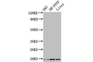 Western Blot Positive WB detected in: U87 whole cell lysate, SH-SY5Y whole cell lysate, Mouse liver tissue All lanes: TSLP antibody at 3. (Thymic Stromal Lymphopoietin 抗体  (AA 29-159))