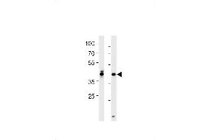 DANRE hoxa1a Antibody (Center) Azb10012a western blot analysis in zebra fish brain and heart tissue lysates (35 μg/lane). (HOXA1A 抗体  (AA 192-219))