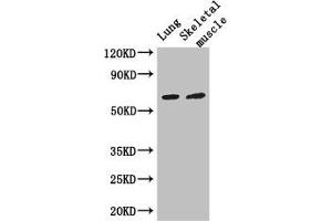 Western Blot Positive WB detected in: Mouse lung tissue, Mouse skeletal muscle tissue All lanes: PAK3 antibody at 3 μg/mL Secondary Goat polyclonal to rabbit IgG at 1/50000 dilution Predicted band size: 63, 61, 65 kDa Observed band size: 63 kDa (PAK3 抗体  (AA 70-190))