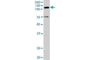 AXL MaxPab rabbit polyclonal antibody. (AXL 抗体  (AA 1-894))