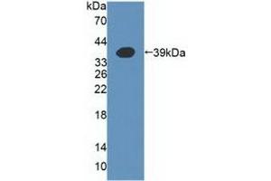 Detection of Recombinant a4GALT, Human using Polyclonal Antibody to Alpha-1,4-Galactosyltransferase (a4GALT) (A4GALT 抗体  (AA 44-353))