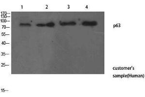 Western Blotting (WB) image for anti-T-Complex 1 (TCP1) (N-Term) antibody (ABIN3178214) (TCP1 alpha/CCTA 抗体  (N-Term))