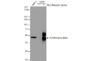 WB Image IL3 Receptor alpha antibody [N2C2], Internal detects IL3 Receptor alpha protein by western blot analysis. (IL3RA 抗体)
