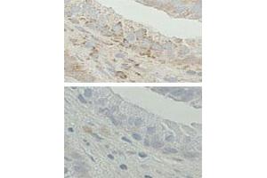 Immunohistochemistry on Formalin-fixed and paraffin-embedded human prostate tissue. (HSD17B10 抗体  (C-Term))