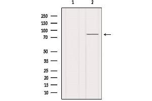 Western blot analysis of extracts from Hela, using PI3-kinase p85-alpha Antibody. (PIK3R1 抗体  (C-Term))