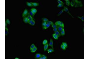 Immunofluorescent analysis of HepG2 cells using ABIN7163584 at dilution of 1:100 and Alexa Fluor 488-congugated AffiniPure Goat Anti-Rabbit IgG(H+L) (CD36 抗体  (AA 191-376))