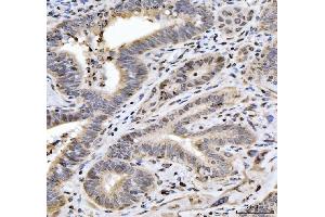 IHC analysis of HES5 using anti-HES5 antibody (ABIN7598966).