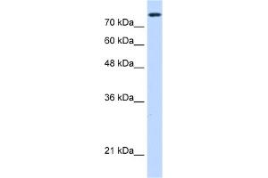 WB Suggested Anti-NCAPH Antibody Titration:  0. (NCAPH 抗体  (C-Term))