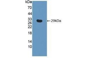 Detection of Recombinant ITGb6, Human using Polyclonal Antibody to Integrin Beta 6 (ITGb6) (ITGB6 抗体  (AA 131-371))