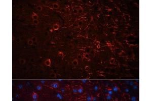 Immunofluorescence analysis of Mouse brain using Aquaporin 4 Polyclonal Antibody at dilution of 1:100 (40x lens). (Aquaporin 4 抗体)