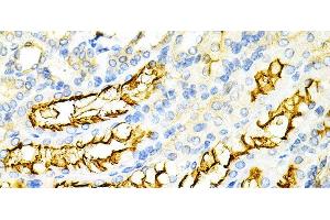 Immunohistochemistry of paraffin-embedded Mouse kidney using PPP2R4 Polyclonal Antibody at dilution of 1:200 (40x lens). (PPP2R4 抗体)