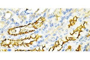 Immunohistochemistry of paraffin-embedded Mouse kidney using PPP2R4 Polyclonal Antibody at dilution of 1:200 (40x lens).
