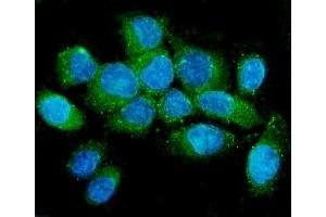 IF analysis of NMI using anti-NMI antibody (ABIN6719489).