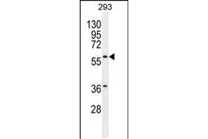Western blot analysis in 293 cell line lysates (35ug/lane). (Carboxypeptidase A2 抗体  (AA 179-208))