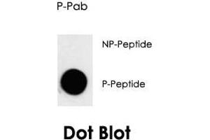 Dot blot analysis of CDK7 (phospho T170) polyclonal antibody  on nitrocellulose membrane. (CDK7 抗体  (pThr170))