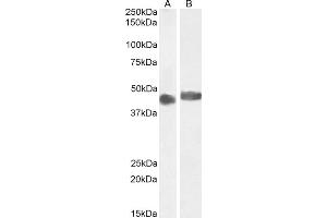 Western Blotting (WB) image for anti-Cerebral Cavernous Malformation 2 (CCM2) (Internal Region) antibody (ABIN185733)