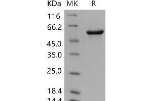 P4HB Protein (His tag)