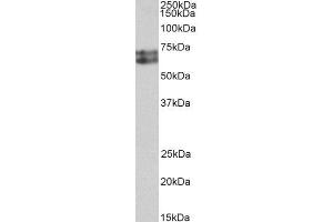ABIN4902656 (0. (HDC 抗体)