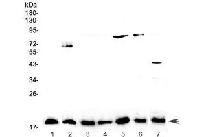 Western blot testing of 1) placenta, 2) PANC-1, 3) rat lymph, 4) rat small intestine, 5) rat testis, 6) rat ovary, and 7) mouse testis lysate with IL-23 antibody at 0. (IL23A 抗体)