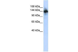 Western Blotting (WB) image for anti-RNA Binding Motif Protein 6 (RBM6) antibody (ABIN2457899) (RBM6 抗体)
