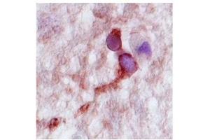 Complexin 2 in human hippocampus was delected using HRP/AEC red color stain. (CPLX2 抗体  (N-Term))