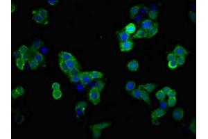 Immunofluorescent analysis of PC-3 cells using ABIN7152234 at dilution of 1:100 and Alexa Fluor 488-congugated AffiniPure Goat Anti-Rabbit IgG(H+L) (SLC1A2 抗体  (AA 460-574))