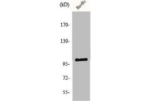 Western Blot analysis of HuvEc cells using NARG1 Polyclonal Antibody (NAA15 抗体  (Internal Region))