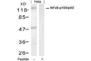 Image no. 1 for anti-Nuclear Factor of kappa Light Polypeptide Gene Enhancer in B-Cells 1 (NFKB1) (Ser927) antibody (ABIN319348) (NFKB1 抗体  (Ser927))