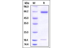 Hamster PCSK9, His Tag on SDS-PAGE under reducing (R) condition.