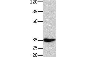 Western blot analysis of Mouse muscle tissue, using HOXA11 Polyclonal Antibody at dilution of 1:350 (Homeobox A11 抗体)