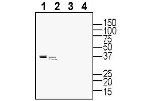 anti-Purinergic Receptor P2Y, G-Protein Coupled, 10 (P2RY10) (AA 165-180), (Extracellular) antibody